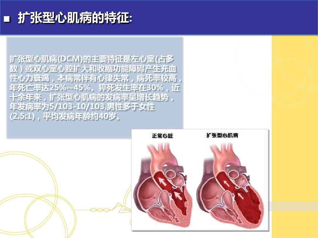 扩心病的最新治疗药品,创新药物助力扩张型心脏病治疗